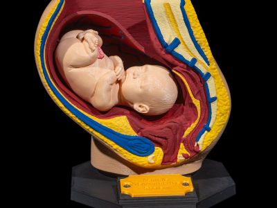 Kvinnelig reproduksjonssystem