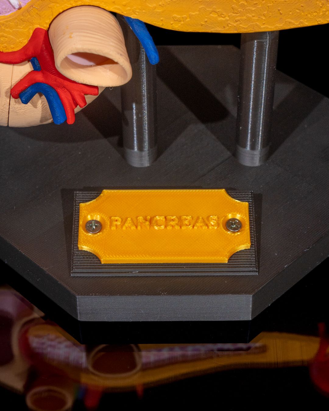 Anatomisk modell av bukspyttkjertelen - Bilde 10