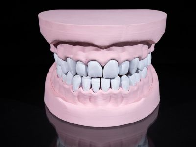 Øvre og nedre tannbue